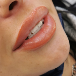 bouche joanna dermo